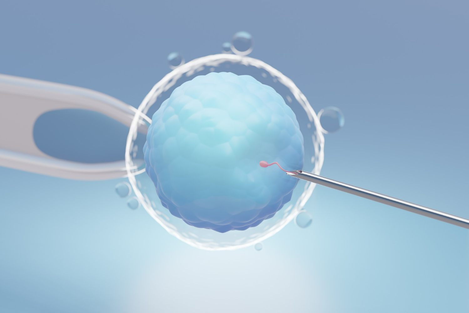 intra cytoplasmic sperm injection treatment