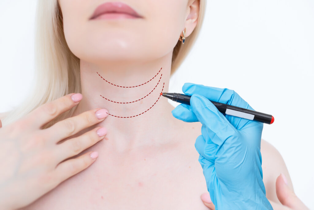 necklift treatment