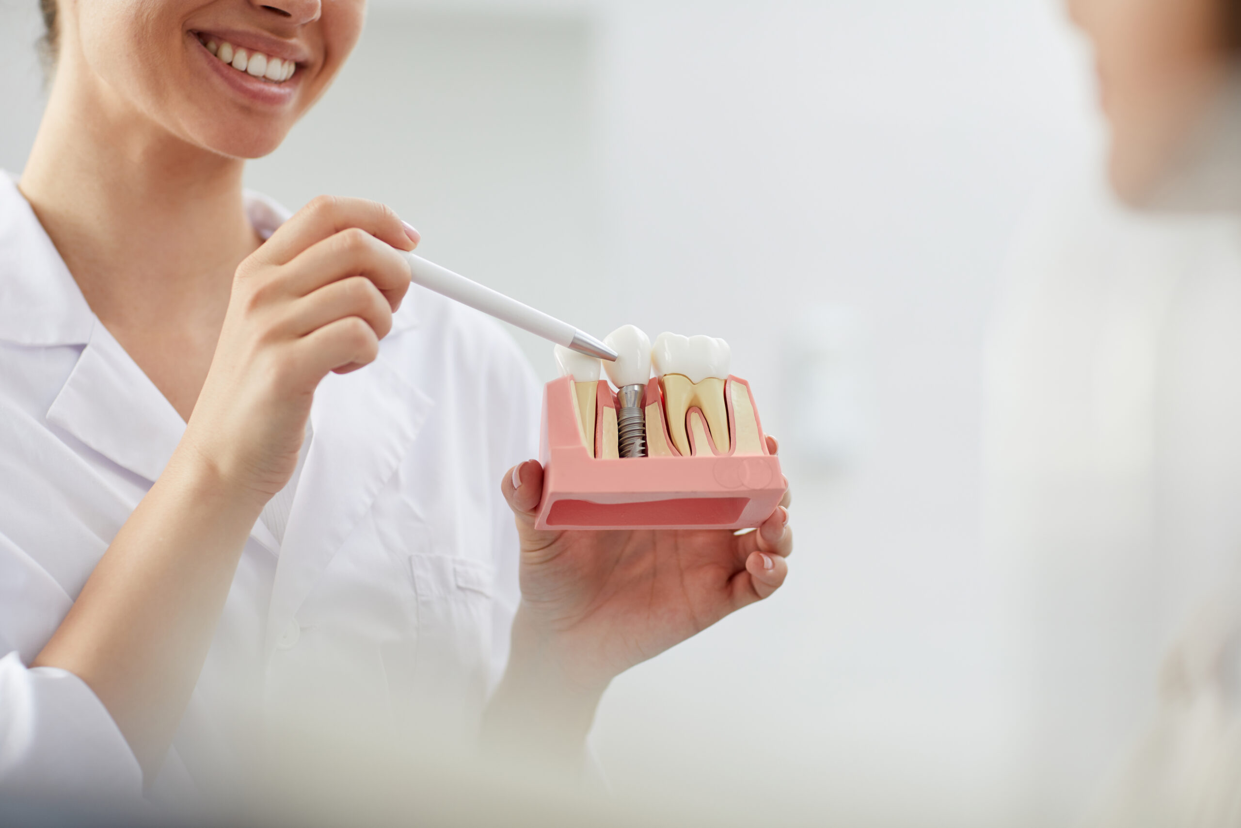 dental implants treatment