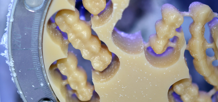 Exploring the Role of 3D Printing in Modern Dental Solutions